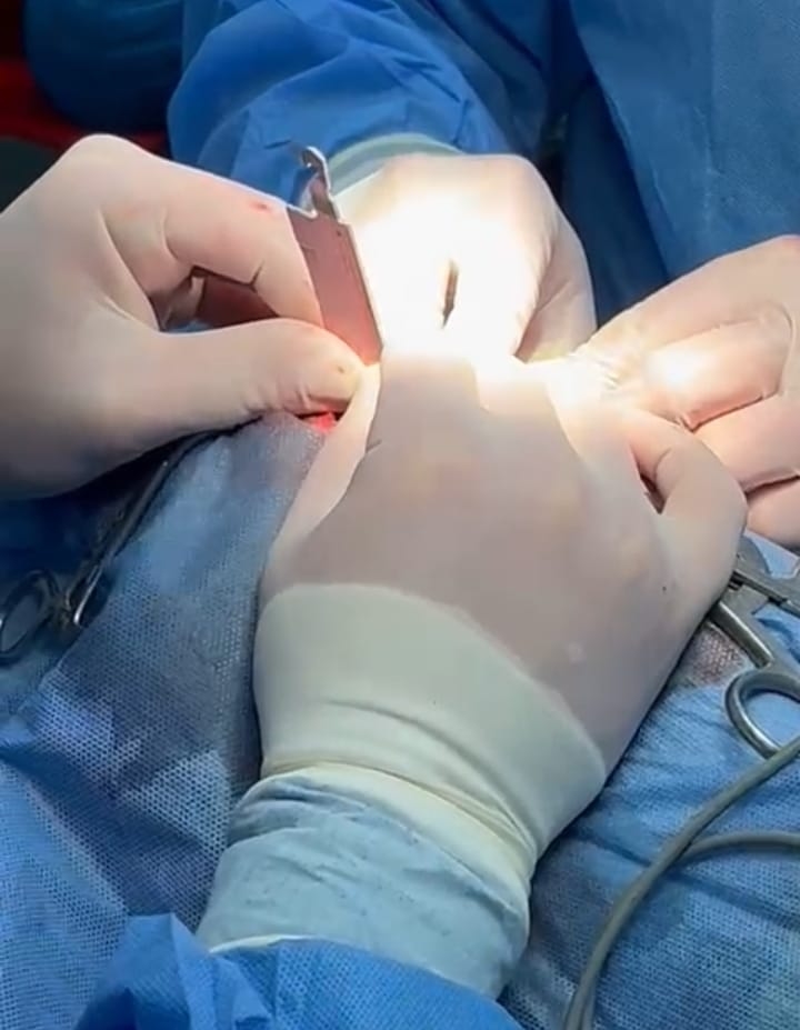 Veterinario neurocirujano logró extraer cuchillo clavado a Baby